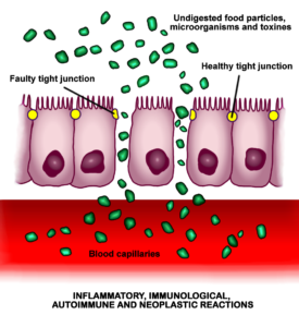 Increased intestinal permeability